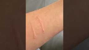 Cat aggressively bites owner and then says sorry  #cat  #cats #shorts